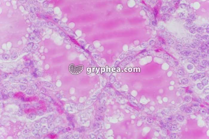 Thyroïde x160 - gryphea.org